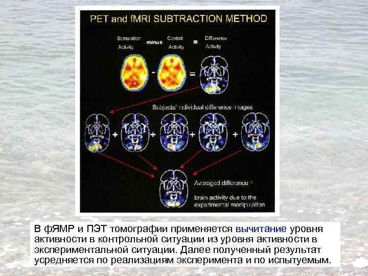 В ф. ЯМР и ПЭТ томографии применяется вычитание уровня активности в контрольной ситуации из