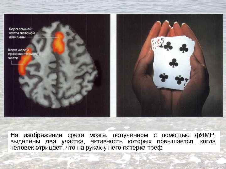 На изображении среза мозга, полученном с помощью ф. ЯМР, выделены два участка, активность которых