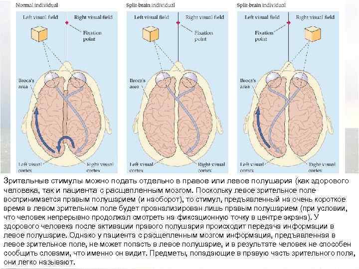 Зрительные стимулы можно подать отдельно в правое или левое полушария (как здорового человека, так