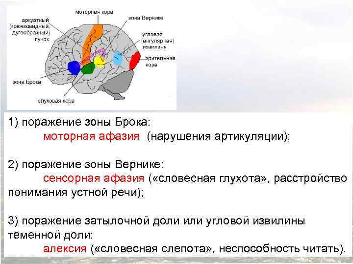 1) поражение зоны Брока: моторная афазия (нарушения артикуляции); 2) поражение зоны Вернике: сенсорная афазия