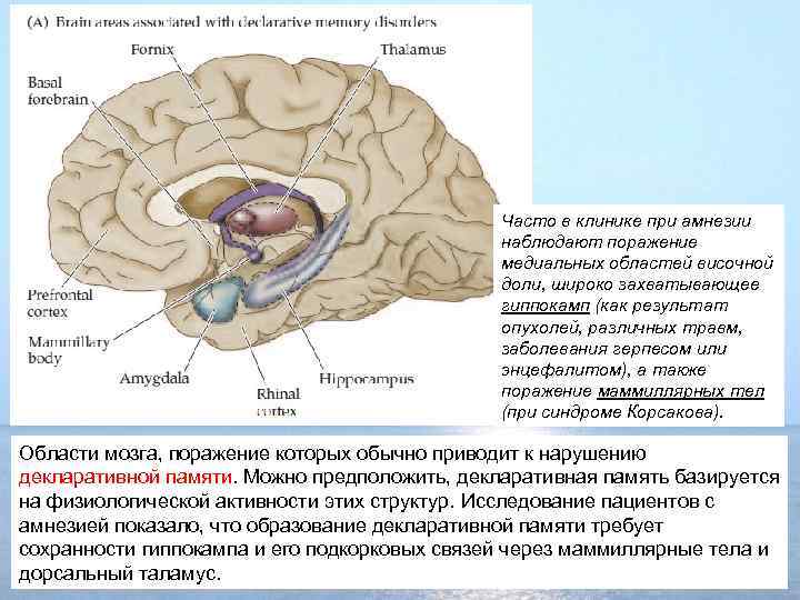 Часто в клинике при амнезии наблюдают поражение медиальных областей височной доли, широко захватывающее гиппокамп