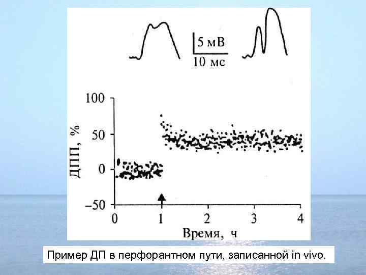 Пример ДП в перфорантном пути, записанной in vivo. 