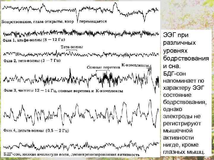ЭЭГ при различных уровнях бодрствования и сна. БДГ-сон напоминает по характеру ЭЭГ состояние бодрствования,