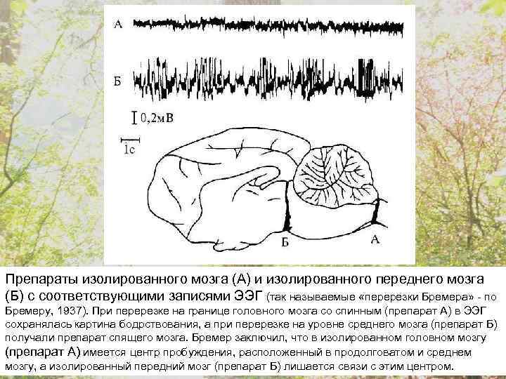 Препараты изолированного мозга (А) и изолированного переднего мозга (Б) с соответствующими записями ЭЭГ (так