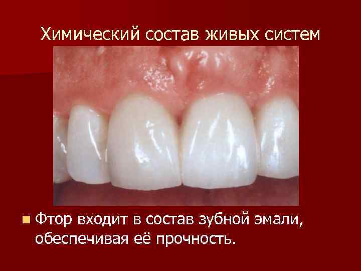 Химический состав живых систем n Фтор входит в состав зубной эмали, обеспечивая её прочность.