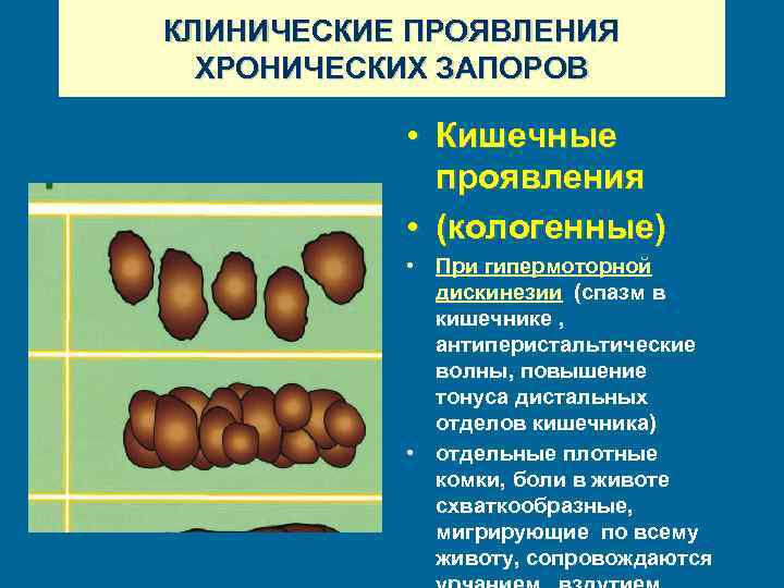 КЛИНИЧЕСКИЕ ПРОЯВЛЕНИЯ ХРОНИЧЕСКИХ ЗАПОРОВ • • Кишечные проявления • (кологенные) • При гипермоторной дискинезии