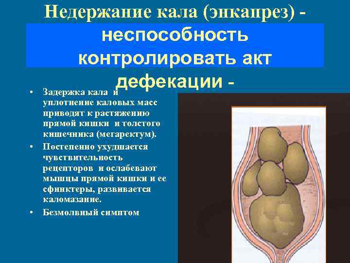  • Недержание кала (энкапрез) неспособность контролировать акт дефекации Задержка кала и уплотнение каловых
