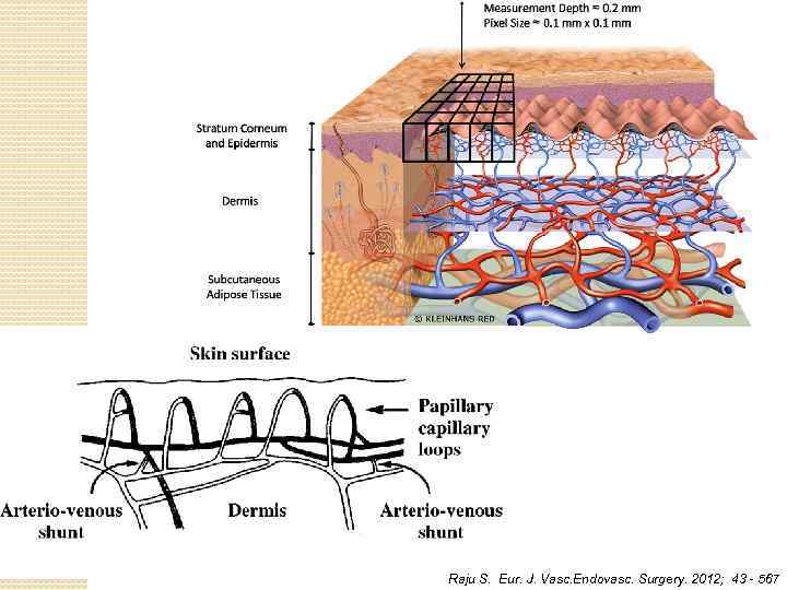 Raju S. Eur. J. Vasc. Endovasc. Surgery. 2012; 43 - 567 