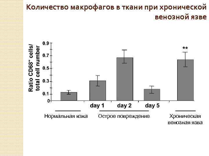 Количество макрофагов в ткани при хронической венозной язве Нормальная кожа Острое повреждение Хроническая венозная