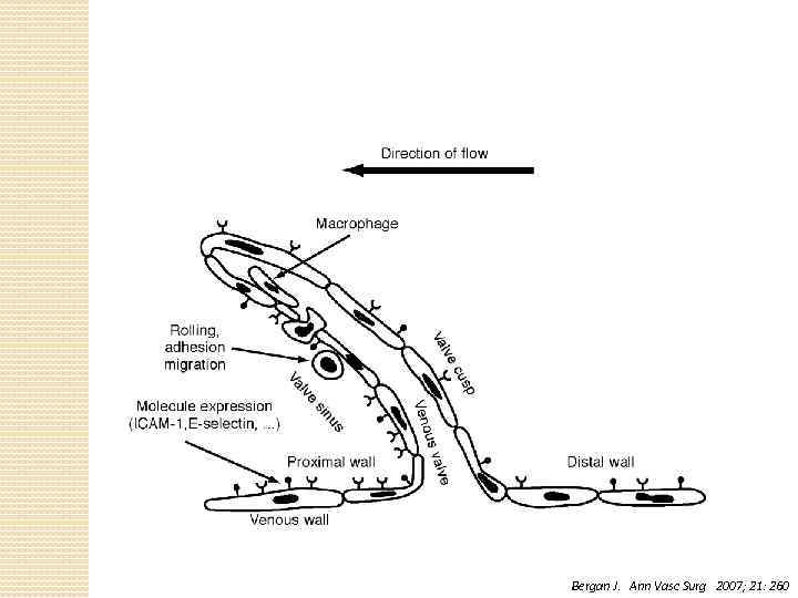 Bergan J. Ann Vasc Surg 2007; 21: 260 