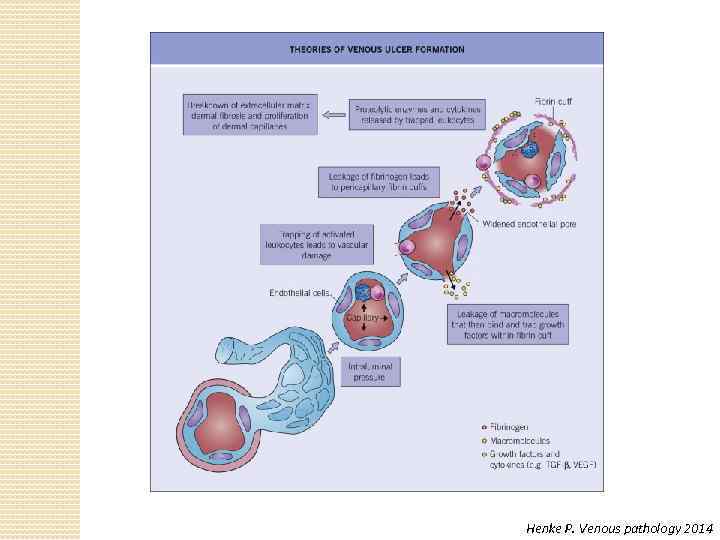 Henke P. Venous pathology 2014 