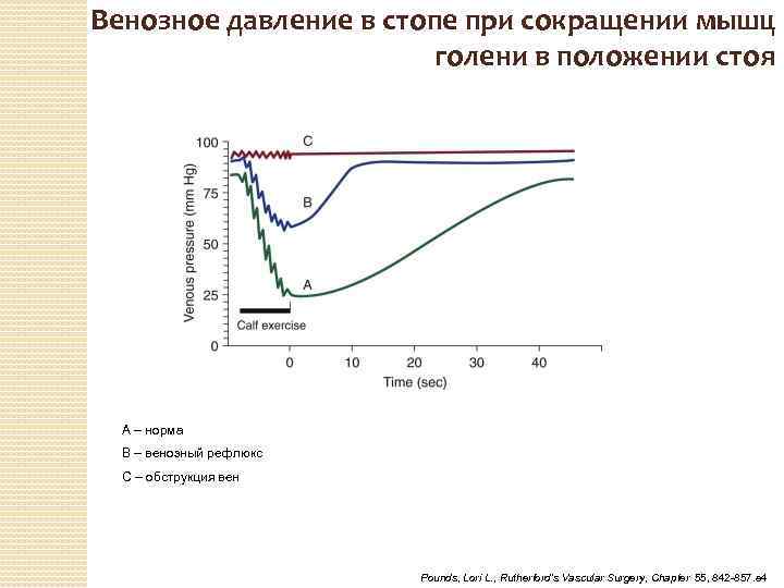 Венозное давление в стопе при сокращении мышц голени в положении стоя А – норма