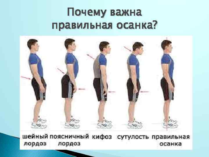 Почему важна правильная осанка? 