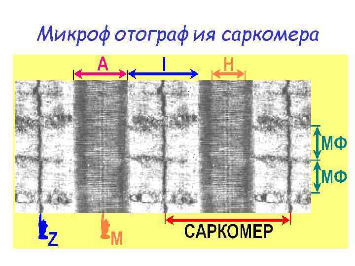 Микрофотография саркомера 