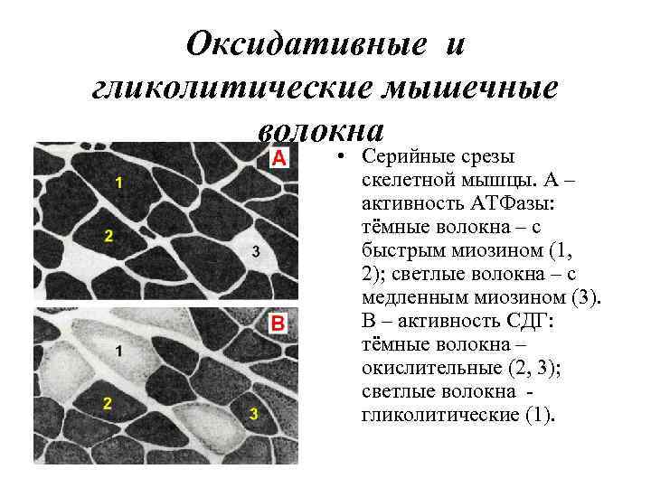 Оксидативные и гликолитические мышечные волокна • Серийные срезы скелетной мышцы. А – активность АТФазы: