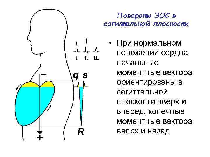 Повороты ЭОС в сагиттальной плоскости • При нормальном положении сердца начальные моментные вектора ориентированы