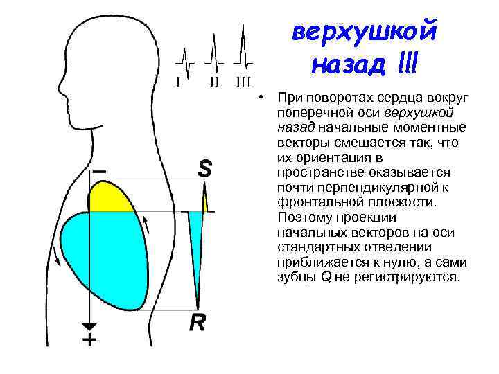 верхушкой назад !!! • При поворотах сердца вокруг поперечной оси верхушкой назад начальные моментные