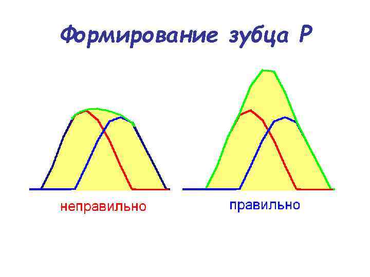 Формирование зубца Р 