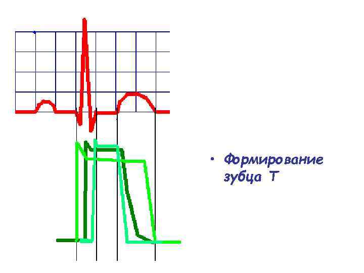  • Формирование зубца Т 