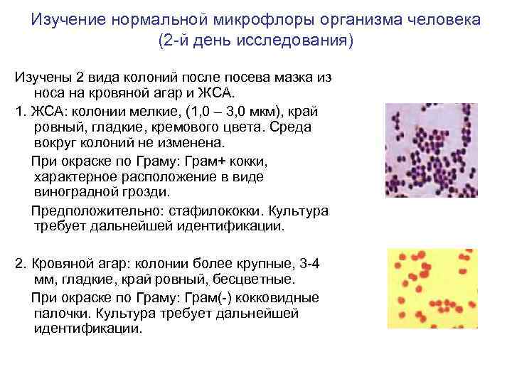 Изучение нормальной микрофлоры организма человека (2 -й день исследования) Изучены 2 вида колоний после