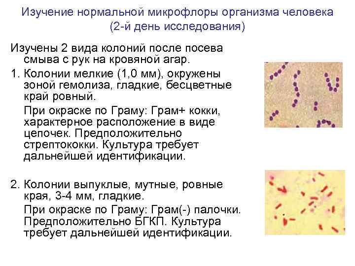 Изучение нормальной микрофлоры организма человека (2 -й день исследования) Изучены 2 вида колоний после