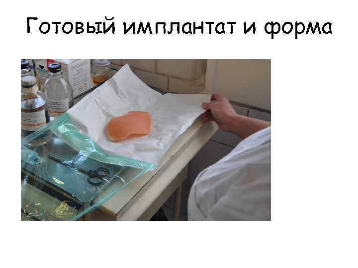 Готовый имплантат и форма 