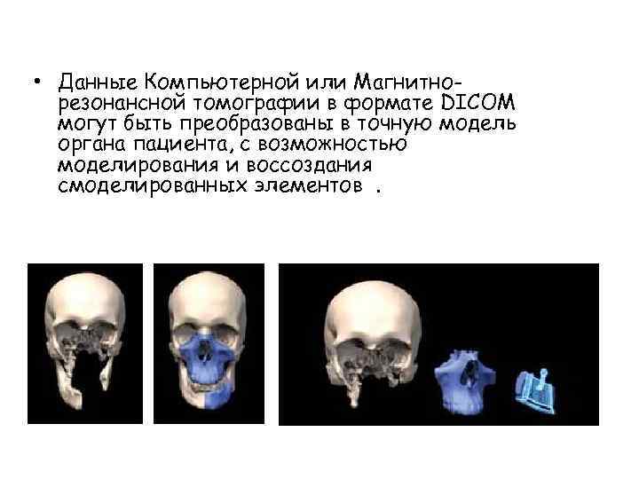  • Данные Компьютерной или Магнитнорезонансной томографии в формате DICOM могут быть преобразованы в