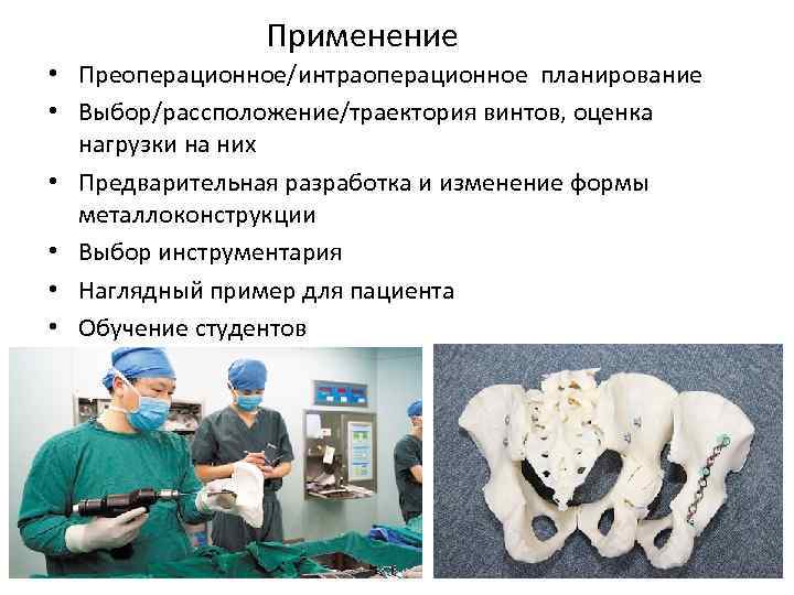 Применение • Преоперационное/интраоперационное планирование • Выбор/рассположение/траектория винтов, оценка нагрузки на них • Предварительная разработка
