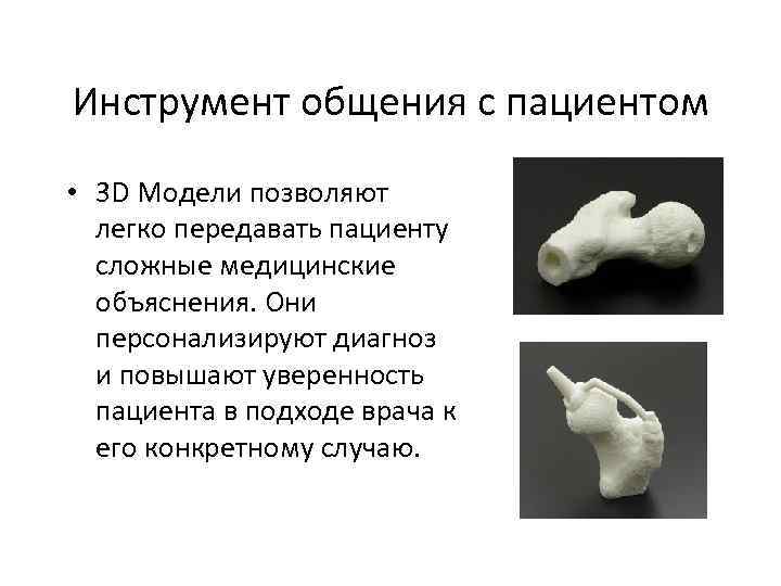 Инструмент общения с пациентом • 3 D Модели позволяют легко передавать пациенту сложные медицинские