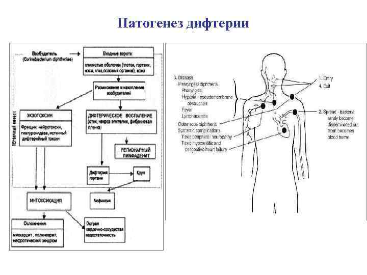 Патогенез дифтерии 