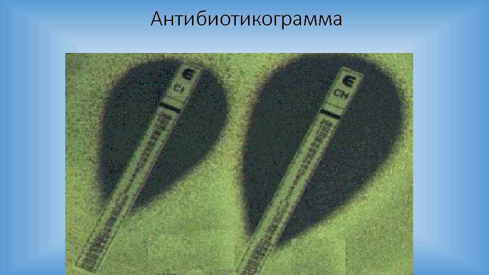 Антибиотикограмма 