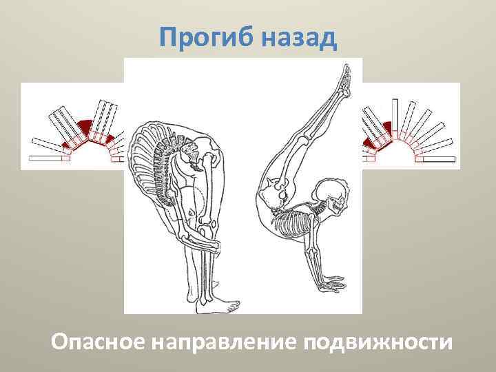 Прогиб назад Опасное направление подвижности 