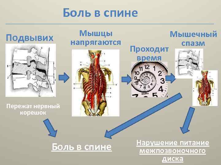 Боль в спине Подвывих Мышцы напрягаются Мышечный спазм Проходит время Пережат нервный корешок Боль