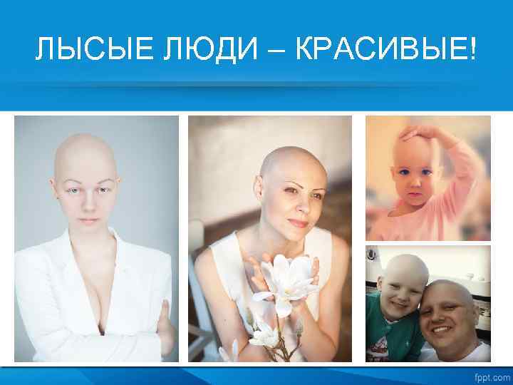 ЛЫСЫЕ ЛЮДИ – КРАСИВЫЕ! 