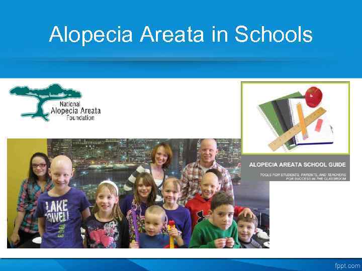 Alopecia Areata in Schools 