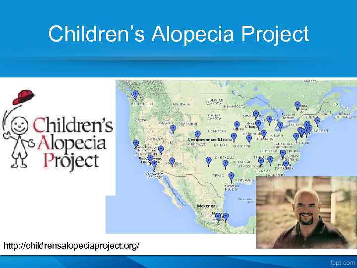 Сhildren’s Alopecia Project http: //childrensalopeciaproject. org/ 