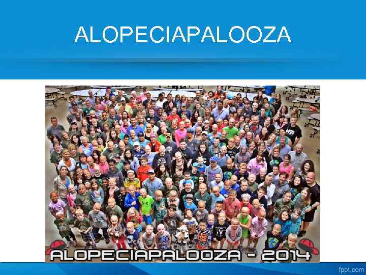 ALOPECIAPALOOZA 
