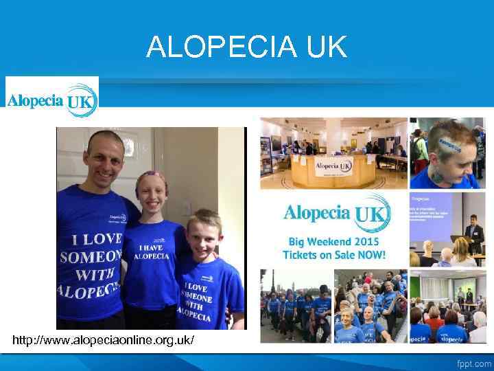 ALOPECIA UK http: //www. alopeciaonline. org. uk/ 