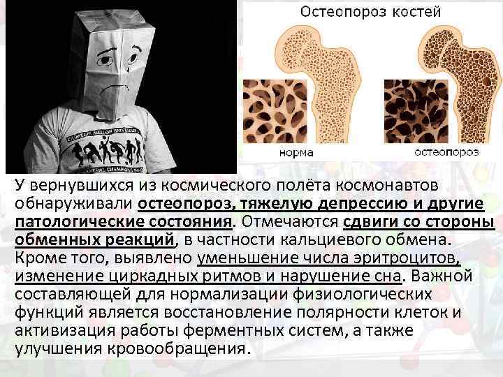 У вернувшихся из космического полёта космонавтов обнаруживали остеопороз, тяжелую депрессию и другие патологические состояния.