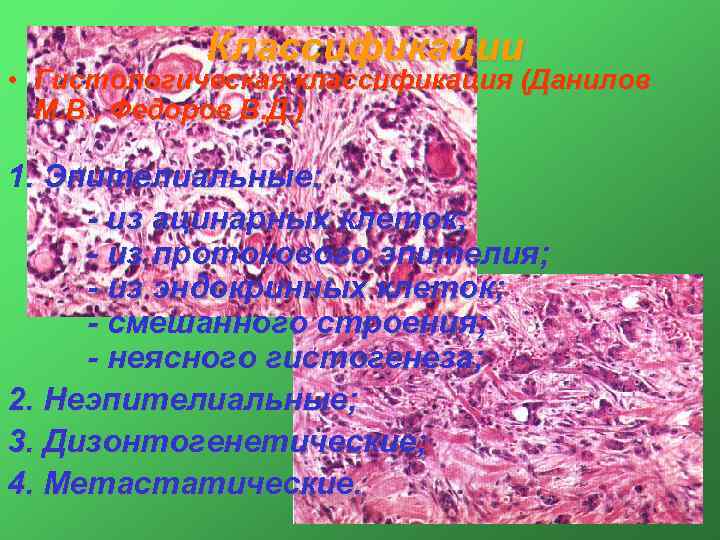 Классификации • Гистологическая классификация (Данилов М. В. , Федоров В. Д. ) 1. Эпителиальные:
