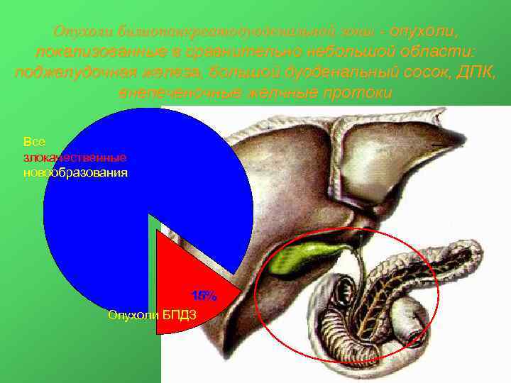 Опухоли билиопанкреатодуоденальной зоны - опухоли, локализованные в сравнительно небольшой области: поджелудочная железа, большой дуоденальный