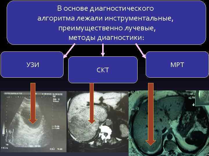 В основе диагностического алгоритма лежали инструментальные, преимущественно лучевые, методы диагностики: УЗИ СКТ МРТ 