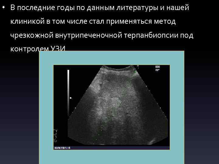  • В последние годы по данным литературы и нашей клиникой в том числе