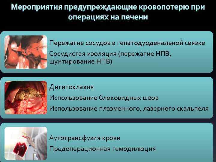 Мероприятия предупреждающие кровопотерю при операциях на печени Пережатие сосудов в гепатодуоденальной связке Сосудистая изоляция