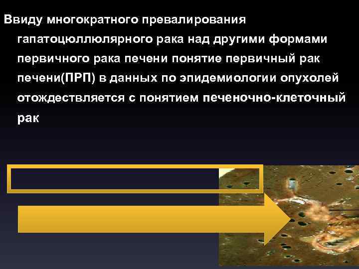 Ввиду многократного превалирования гапатоцюллюлярного рака над другими формами первичного рака печени понятие первичный рак