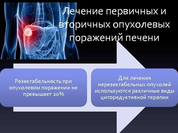 Лечение первичных и вторичных опухолевых поражений печени Резектабельность при опухолевом поражении не превышает 20%