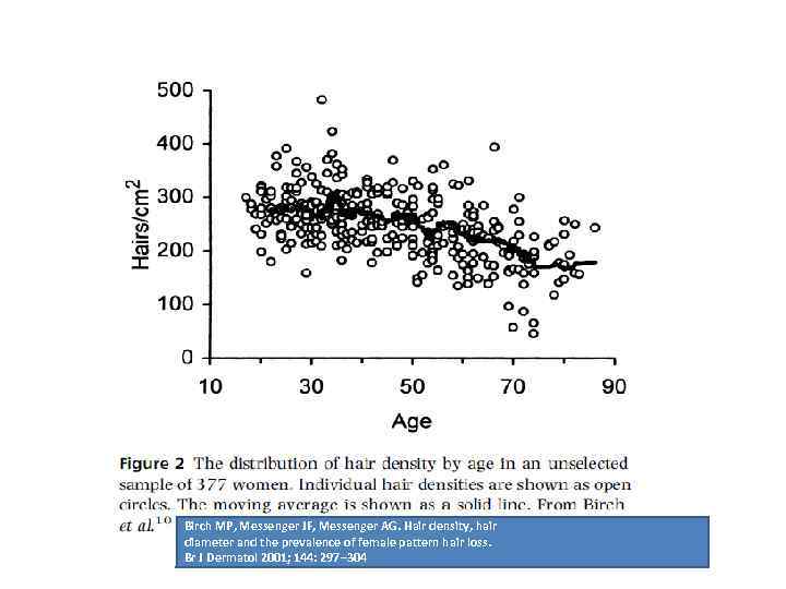 Birch MP, Messenger JF, Messenger AG. Hair density, hair diameter and the prevalence of