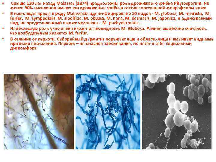  • • Свыше 130 лет назад Malassez (1874) предположил роль дрожжевого грибка Pityrosporum.