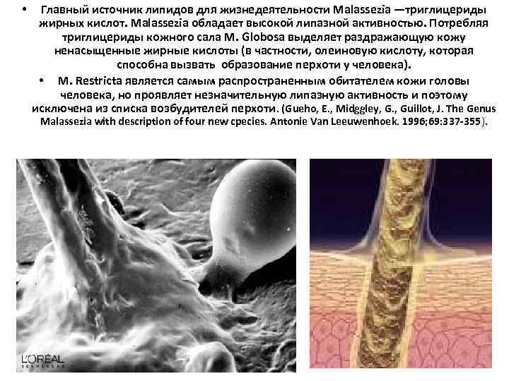  • Главный источник липидов для жизнедеятельности Malassezia —триглицериды жирных кислот. Malassezia обладает высокой