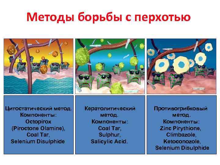Методы борьбы с перхотью Цитостатический метод. Компоненты: Octopirox (Piroctone Olamine), Coal Tar, Selenium Disulphide
